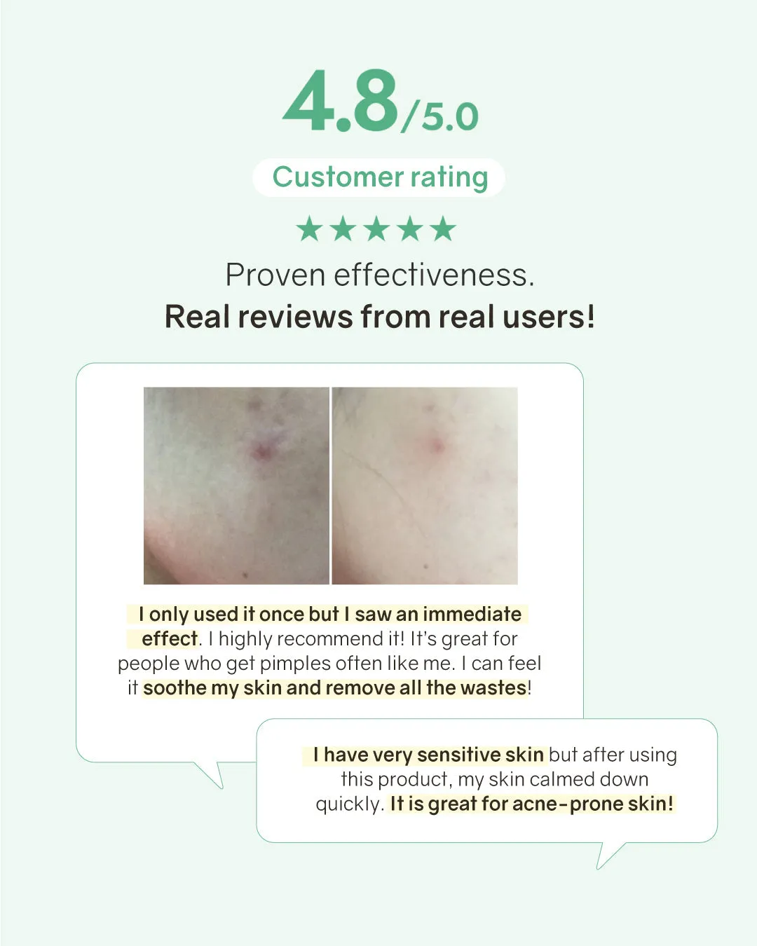 [PROMO] Bonabella Teatree Calming Special